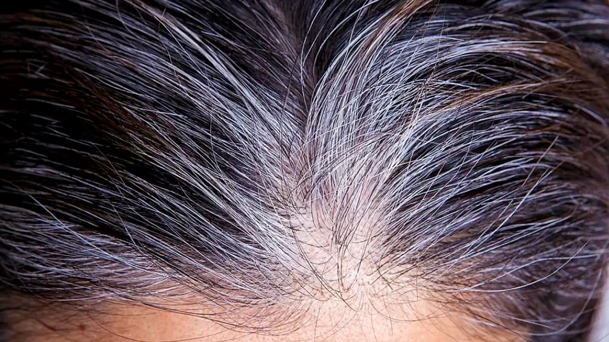 Neue Wege im Umgang mit grauen Haaren: Von Kryotherapie bis zu natürlichen Methoden